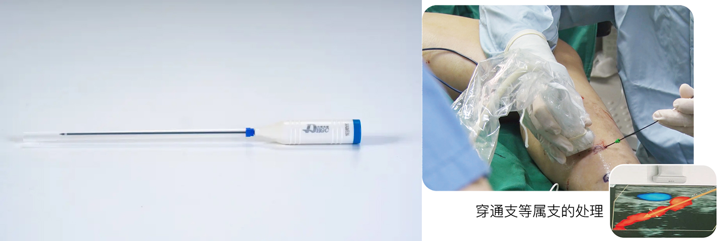 Danhui Co-creates a Comprehensive Solution for Varicose Veins: Showcasing Exclusive Technology at the Central Plains Vascular Conference